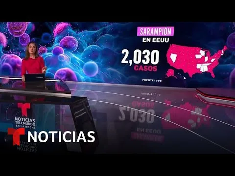 Estados Unidos enfrenta posible récord de casos de sarampión en décadas